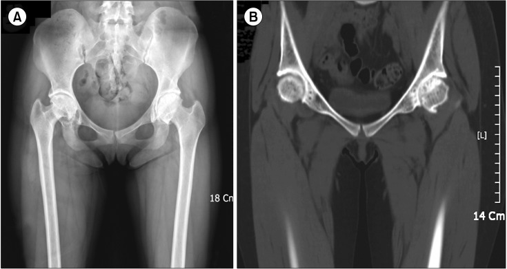 Surgery in patients with congenital factor VII deficiency: A single center experience.