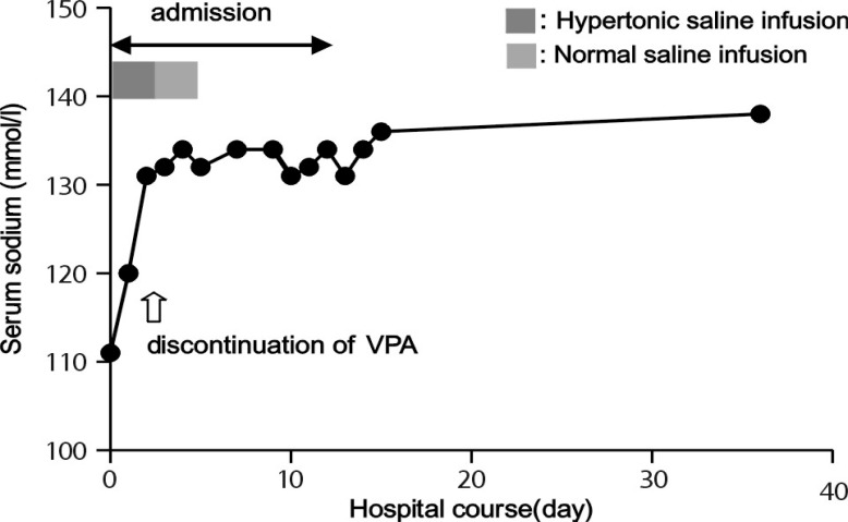 A case of syndrome of inappropriate scretion of anti-diuretic hormone associated with sodium valproate.