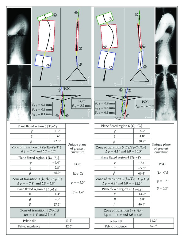 Geometric Structure of 3D Spinal Curves: Plane Regions and Connecting Zones.