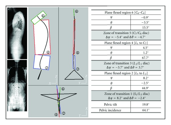 Geometric Structure of 3D Spinal Curves: Plane Regions and Connecting Zones.