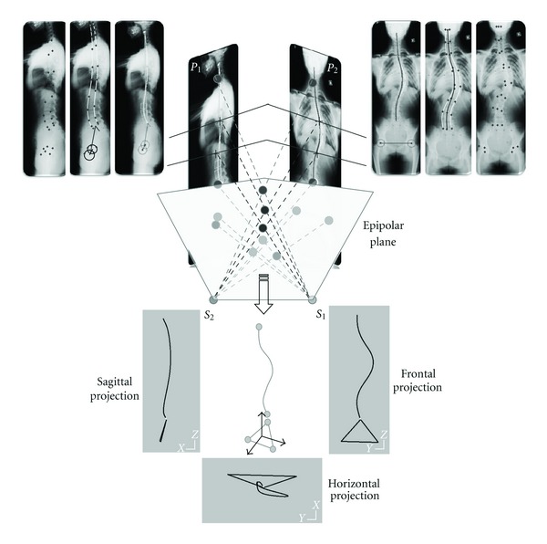 Geometric Structure of 3D Spinal Curves: Plane Regions and Connecting Zones.