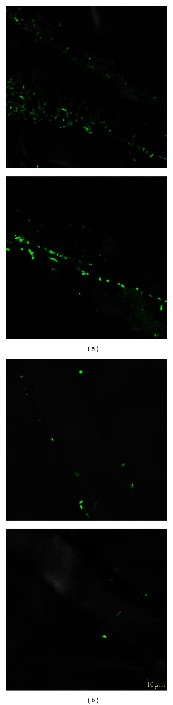 Bacterial growth on chitosan-coated polypropylene textile.