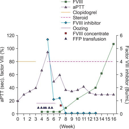 A patient with acquired hemophilia A induced by clopidogrel.