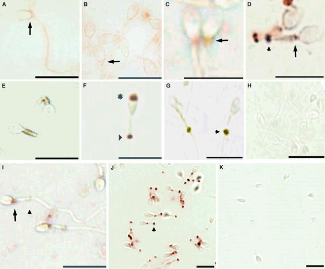 Expression of the vitamin D metabolizing enzyme CYP24A1 at the annulus of human spermatozoa may serve as a novel marker of semen quality