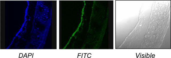 S100A12 and the Airway Smooth Muscle: Beyond Inflammation and Constriction.