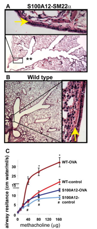 S100A12 and the Airway Smooth Muscle: Beyond Inflammation and Constriction.