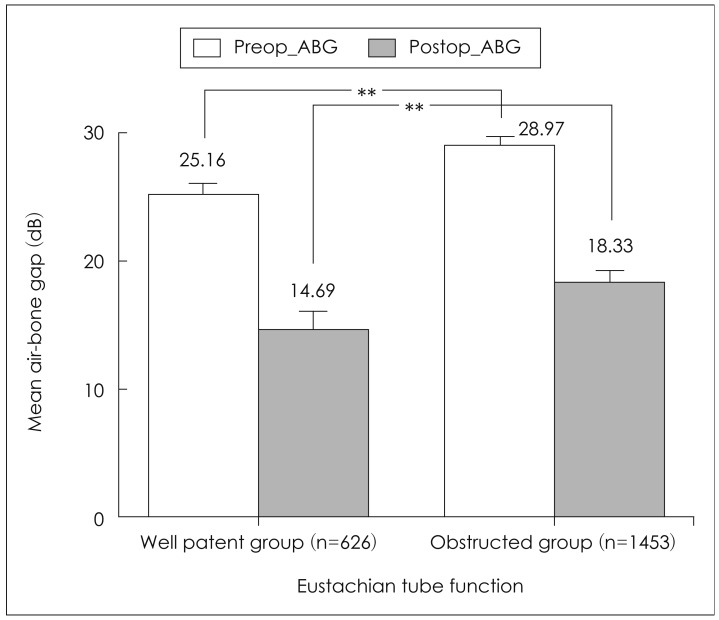 Effects of middle ear lesions on pre and postoperative hearing outcomes in patients with chronic otitis media.