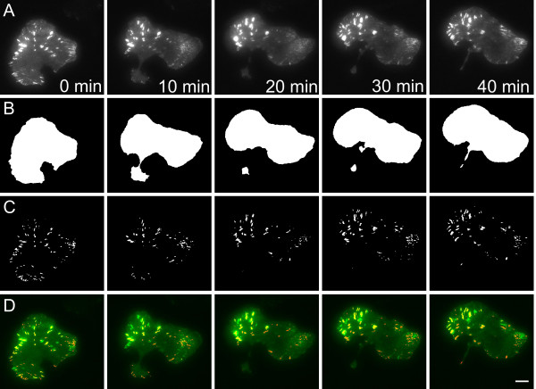 Differences in adhesion and protrusion properties correlate with differences in migration speed under EGF stimulation.