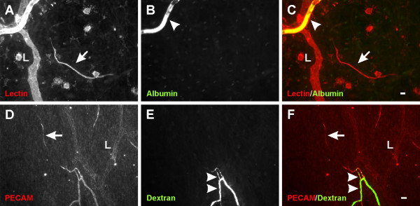 Cell proliferation along vascular islands during microvascular network growth.