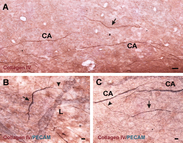 Cell proliferation along vascular islands during microvascular network growth.