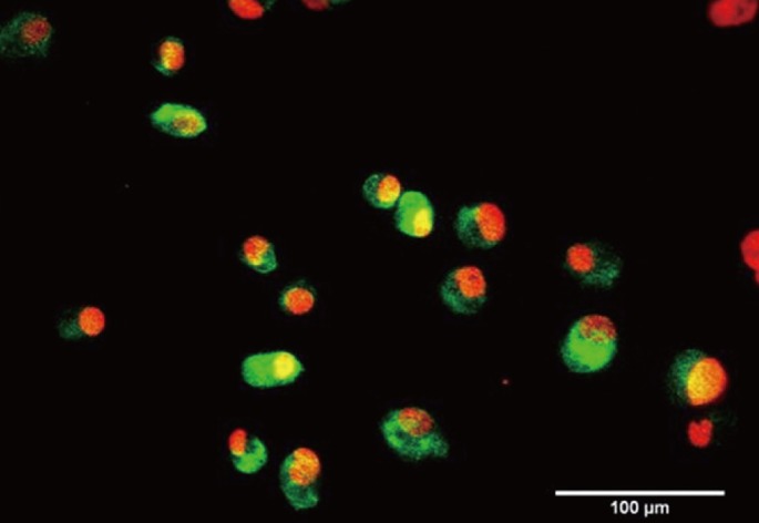 Adipose-tissue-derived Stem Cells Enhance the Healing of Ischemic Colonic Anastomoses: An Experimental Study in Rats.