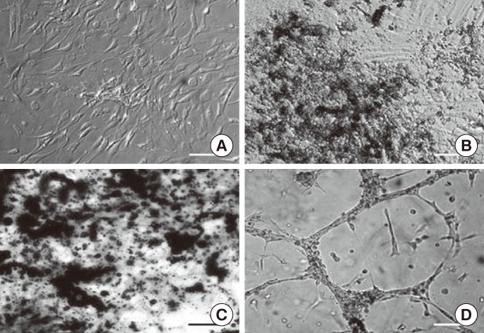 Adipose-tissue-derived Stem Cells Enhance the Healing of Ischemic Colonic Anastomoses: An Experimental Study in Rats.