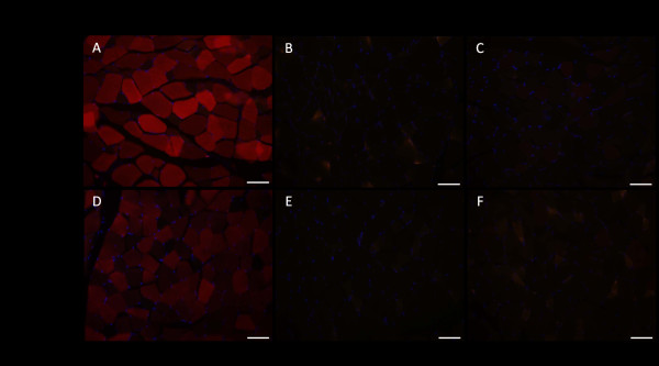 An acidic oligopeptide displayed on AAV2 improves axial muscle tropism after systemic delivery.