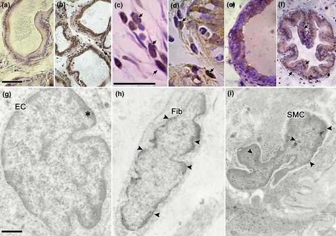 Androgen depletion augments antibacterial prostate host defences in rats