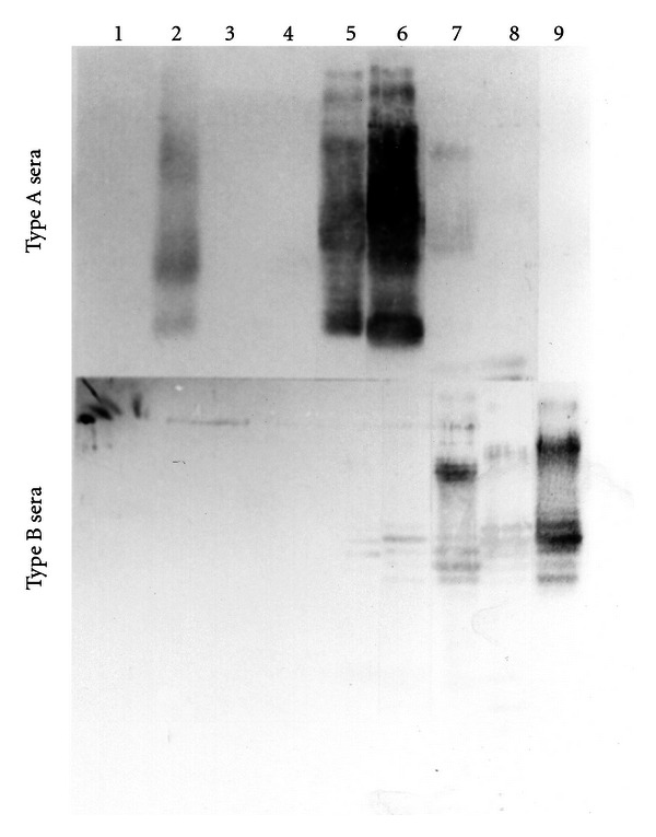 Comparison of the Serological Reactivity of Lipopolysaccharides from Japanese and Western Strains of Helicobacter pylori to Sera from H. pylori-Positive Humans.