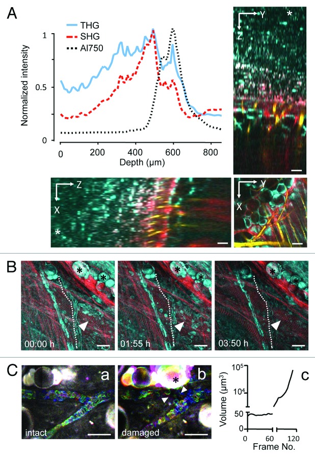 Intravital third harmonic generation microscopy of collective melanoma cell invasion: Principles of interface guidance and microvesicle dynamics.