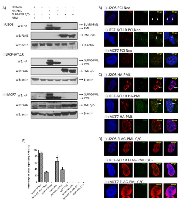 Stable expression of promyelocytic leukaemia (PML) protein in telomerase positive MCF7 cells results in alternative lengthening of telomeres phenotype.