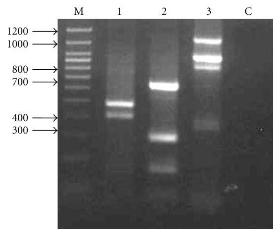 Isolation of Alcohol Dehydrogenase cDNA and Basal Regulatory Region from Metroxylon sagu.