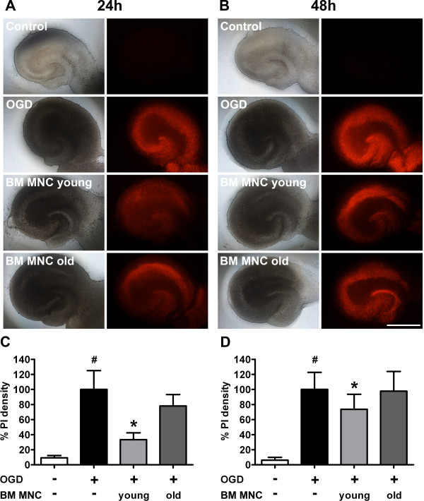 Impact of age on the efficacy of bone marrow mononuclear cell transplantation in experimental stroke.