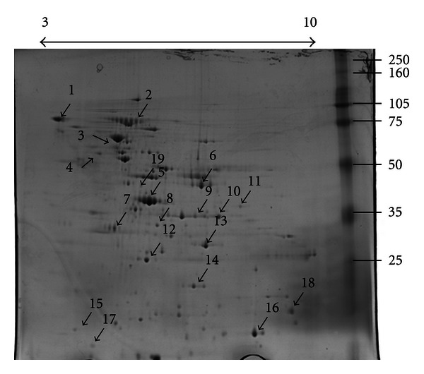 Extracellular Proteins of Mycoplasma synoviae.