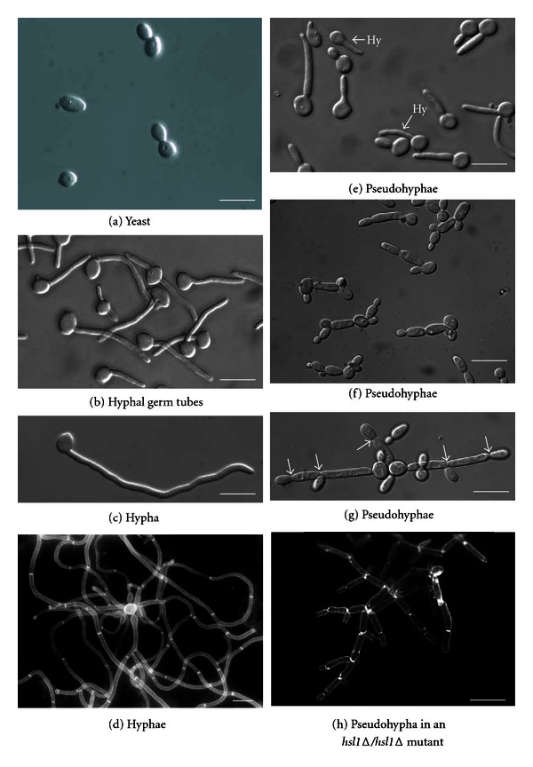 Candida albicans: A Model Organism for Studying Fungal Pathogens.