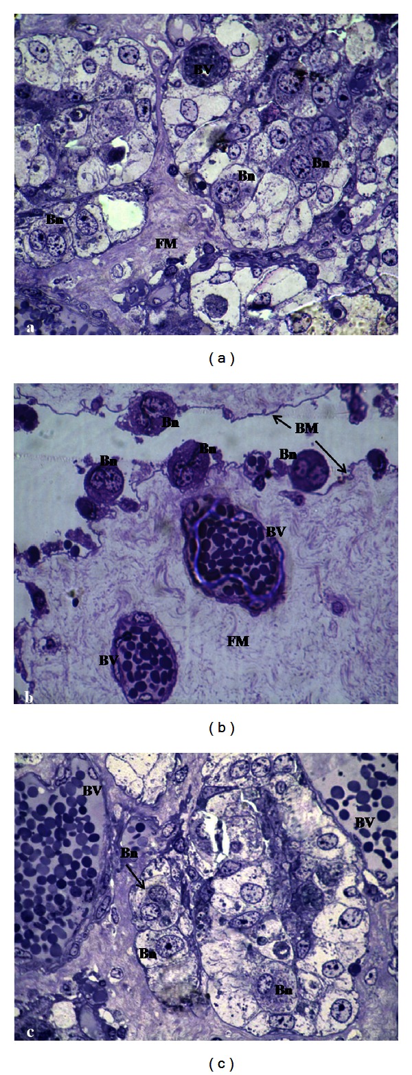 Effect of feed restriction and realimentation with monensin supplementation on placental structure and ultrastructure in anglo-nubian goats.