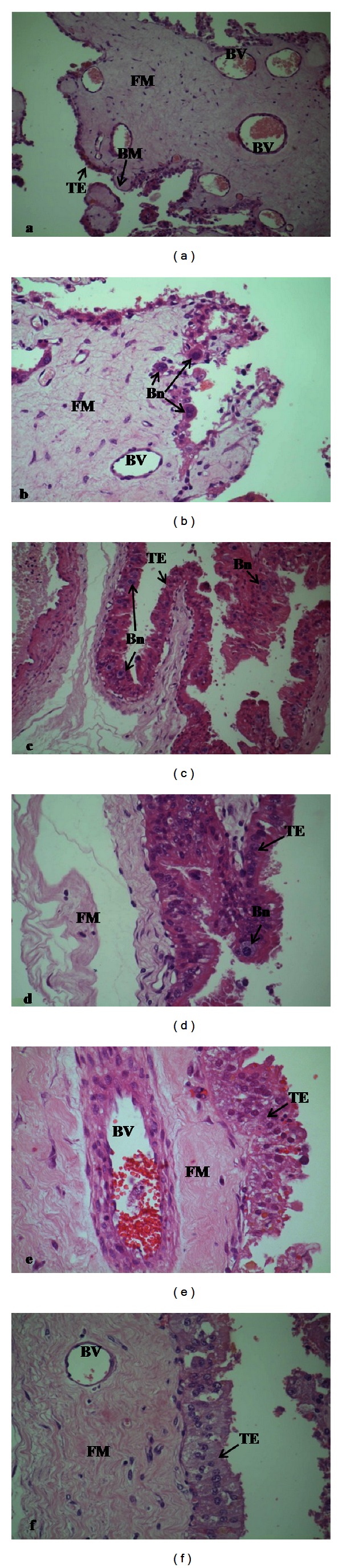 Effect of feed restriction and realimentation with monensin supplementation on placental structure and ultrastructure in anglo-nubian goats.