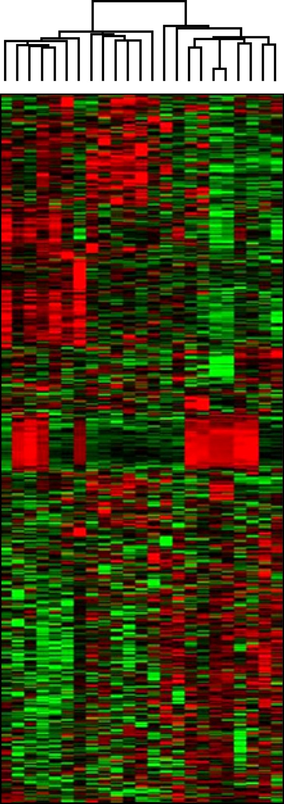 Identification of genes underlying different methylation profiles in refractory anemia with excess blast and refractory cytopenia with multilineage dysplasia in myelodysplastic syndrome.