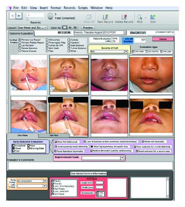 Investing in a surgical outcomes auditing system.