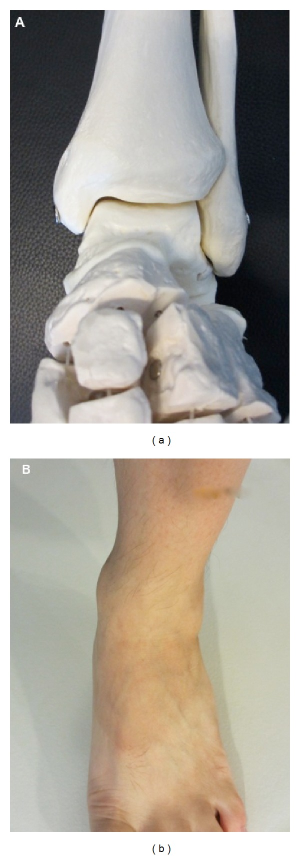 Open and arthroscopic surgical anatomy of the ankle.