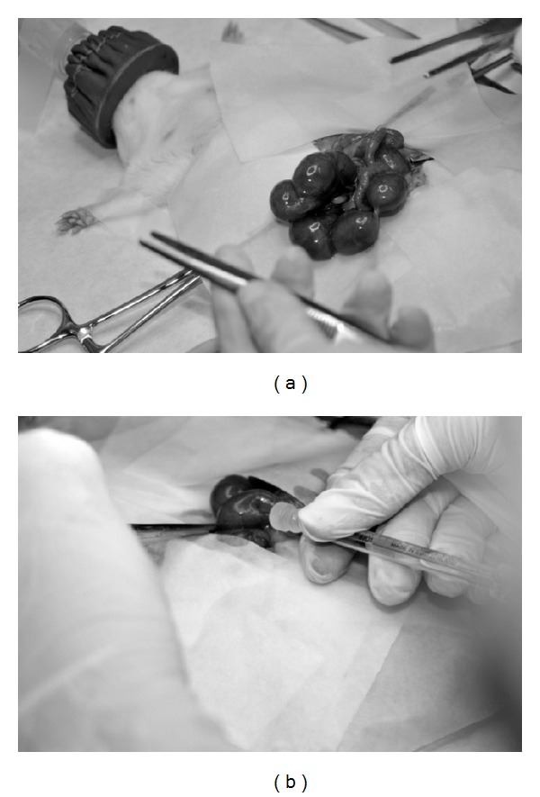 In utero hepatocellular transplantation in rats.