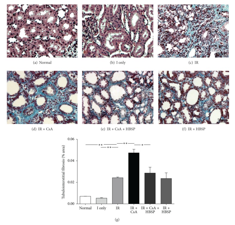 Protective effects of HBSP on ischemia reperfusion and cyclosporine a induced renal injury.