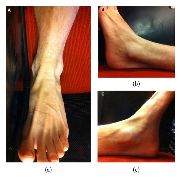 Open and arthroscopic surgical anatomy of the ankle.