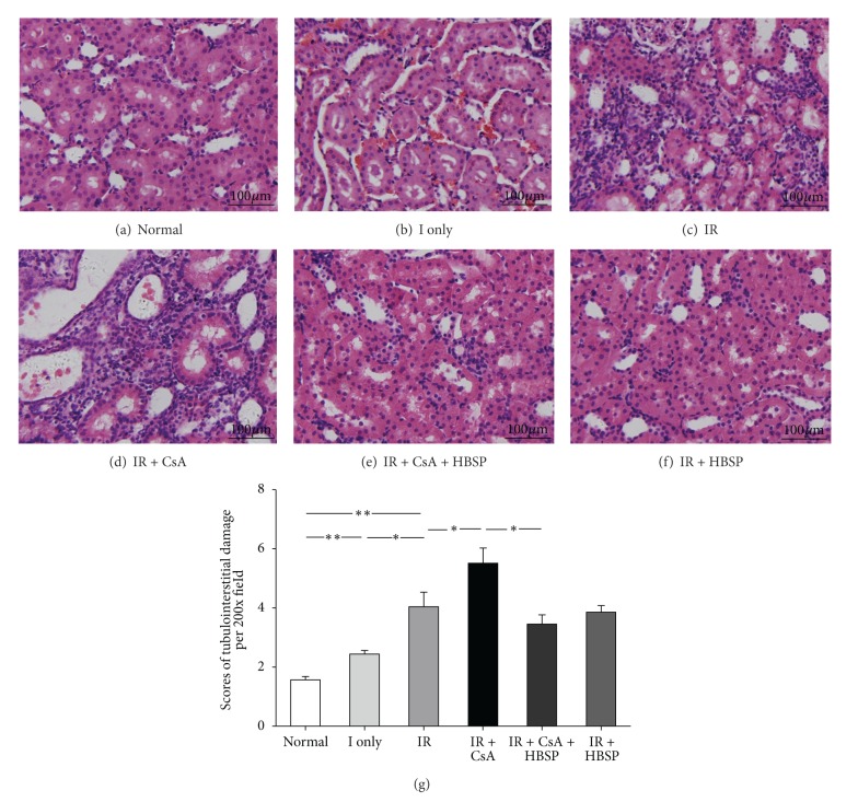 Protective effects of HBSP on ischemia reperfusion and cyclosporine a induced renal injury.