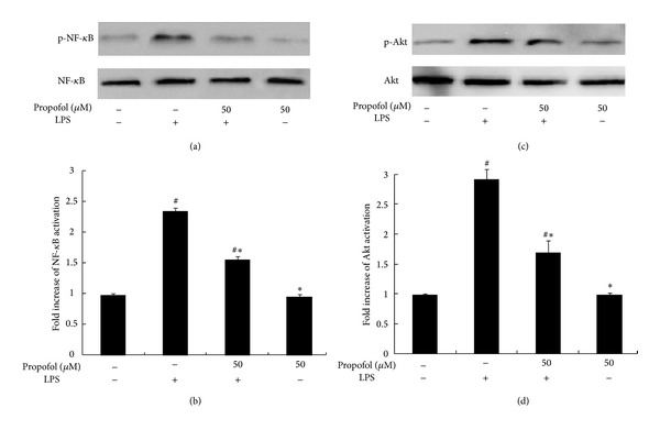 Propofol reduces lipopolysaccharide-induced, NADPH oxidase (NOX 2) mediated TNF- α and IL-6 production in macrophages.