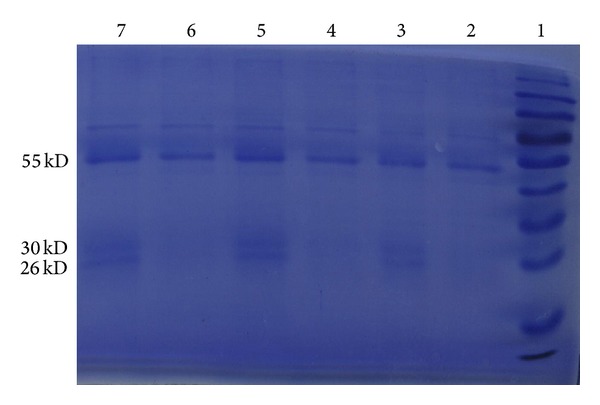 A possible role of HMGB1 in DNA demethylation in CD4+ T cells from patients with systemic lupus erythematosus.