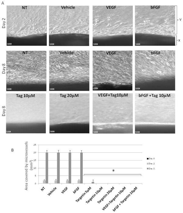 <i>In-Vitro</i> and <i>Ex-Vivo</i> Investigations of the Microtubule Binding Drug Targetin on Angiogenesis.
