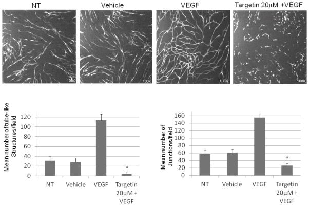 <i>In-Vitro</i> and <i>Ex-Vivo</i> Investigations of the Microtubule Binding Drug Targetin on Angiogenesis.