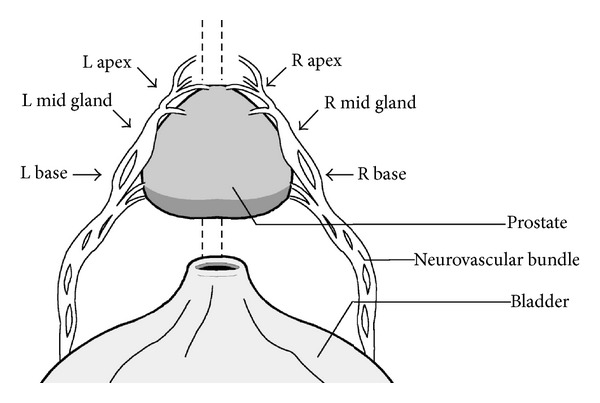 A Pilot Study of Laparoscopic Doppler Ultrasound Probe to Map Arterial Vascular Flow within the Neurovascular Bundle during Robot-Assisted Radical Prostatectomy.