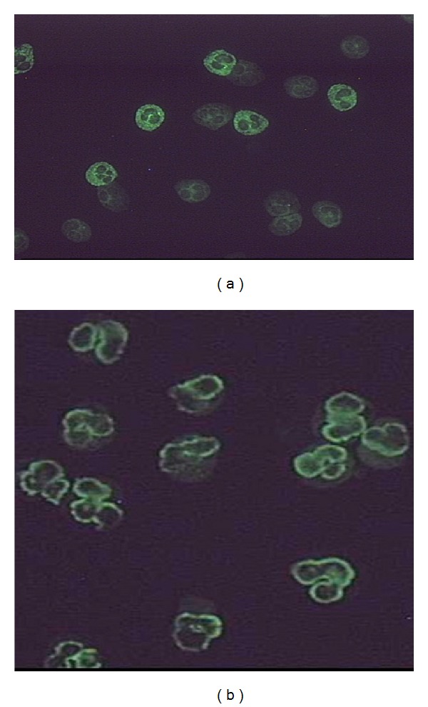 Pediatric inflammatory bowel disease with cytoplasmic staining of antineutrophil cytoplasmic antibodies.