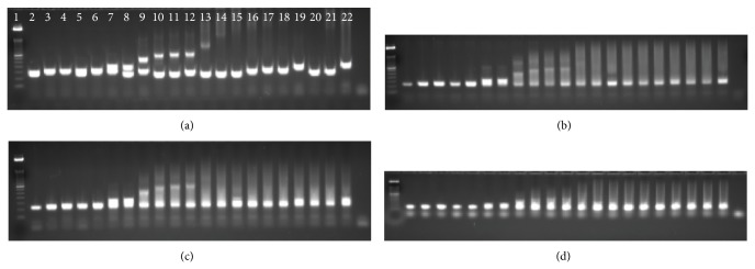 Simple Repeat-Primed PCR Analysis of the Myotonic Dystrophy Type 1 Gene in a Clinical Diagnostics Environment.