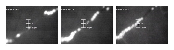 Intravital microscopic research of microembolization with degradable starch microspheres.