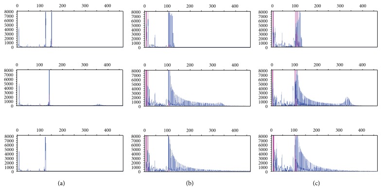 Simple Repeat-Primed PCR Analysis of the Myotonic Dystrophy Type 1 Gene in a Clinical Diagnostics Environment.