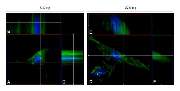 Targeted antiepidermal growth factor receptor (cetuximab) immunoliposomes enhance cellular uptake in vitro and exhibit increased accumulation in an intracranial model of glioblastoma multiforme.