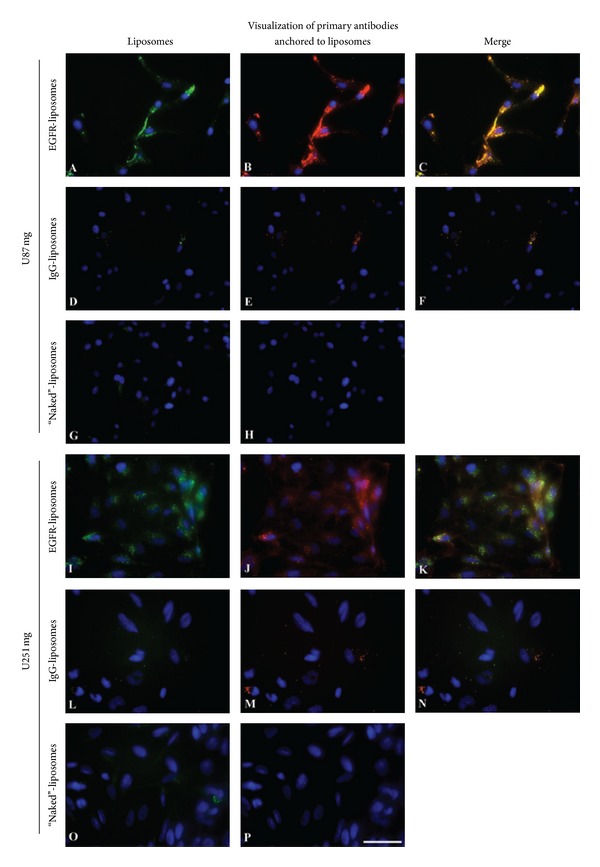 Targeted antiepidermal growth factor receptor (cetuximab) immunoliposomes enhance cellular uptake in vitro and exhibit increased accumulation in an intracranial model of glioblastoma multiforme.