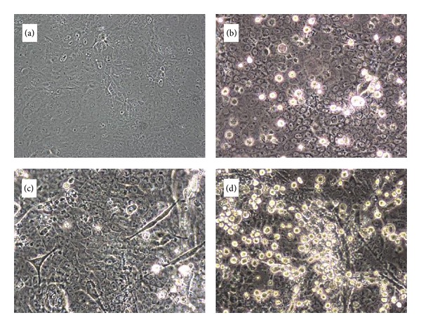 Detection and Isolation of Airborne Influenza A H3N2 Virus Using a Sioutas Personal Cascade Impactor Sampler.