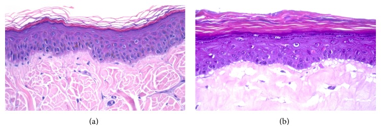 Effects of Essential Oils and Polyunsaturated Fatty Acids on Canine Skin Equivalents: Skin Lipid Assessment and Morphological Evaluation.