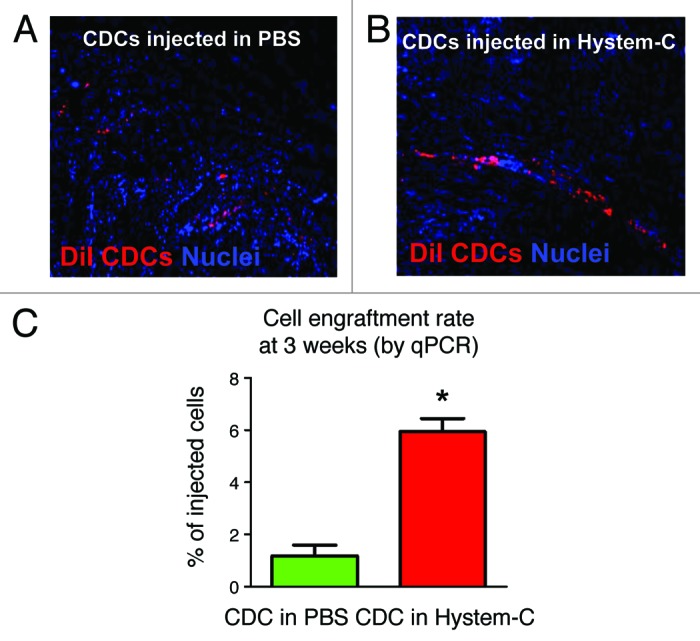 Enhancing retention and efficacy of cardiosphere-derived cells administered after myocardial infarction using a hyaluronan-gelatin hydrogel.