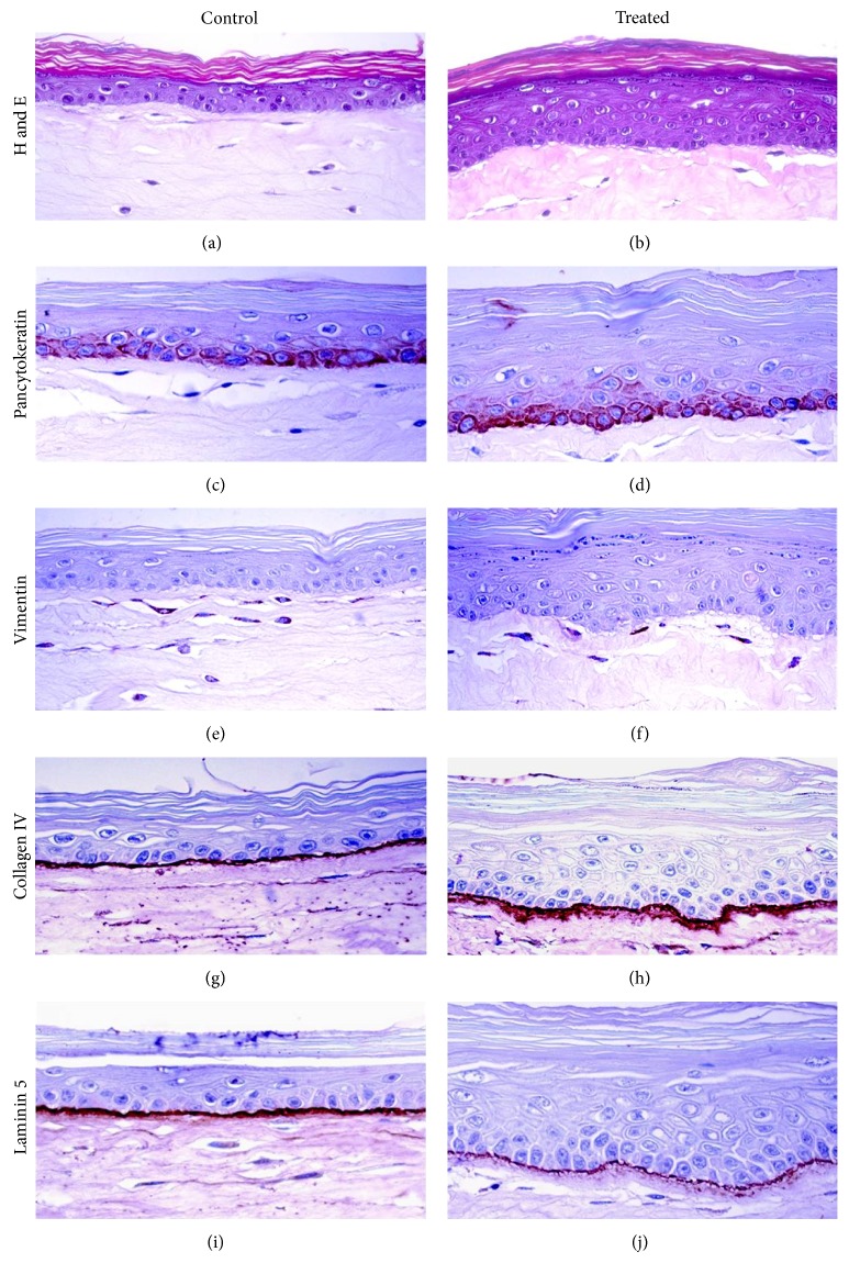 Effects of Essential Oils and Polyunsaturated Fatty Acids on Canine Skin Equivalents: Skin Lipid Assessment and Morphological Evaluation.