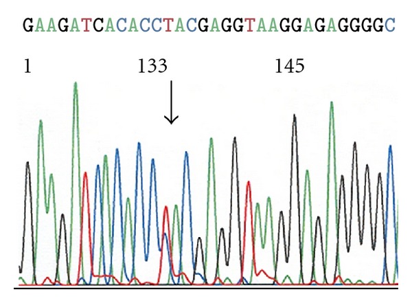 CD79B and MYD88 Mutations in Splenic Marginal Zone Lymphoma.